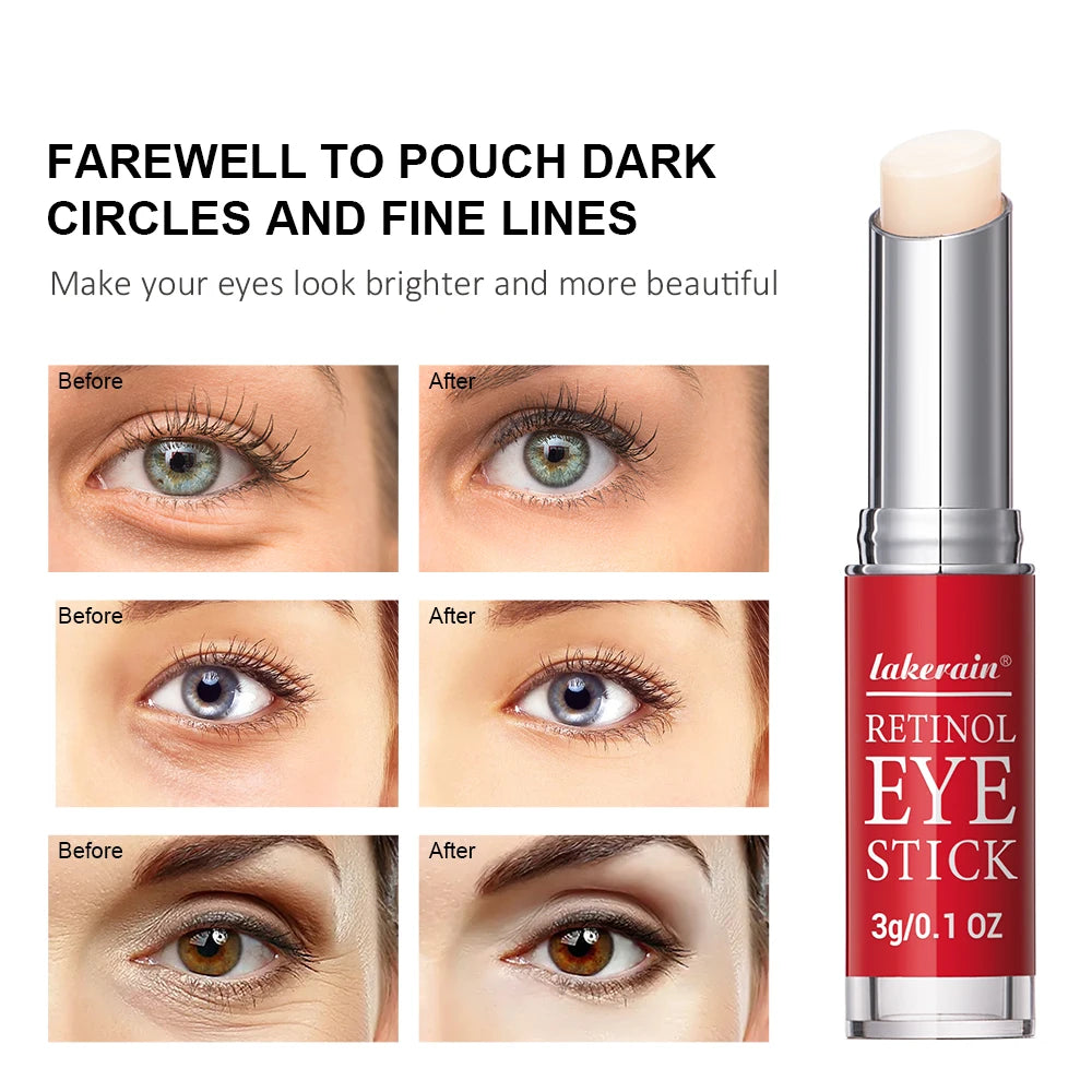 Retinol Eye Cream Lightening Dark Circles Firming Skin Instant Eye Repair Serum Stick