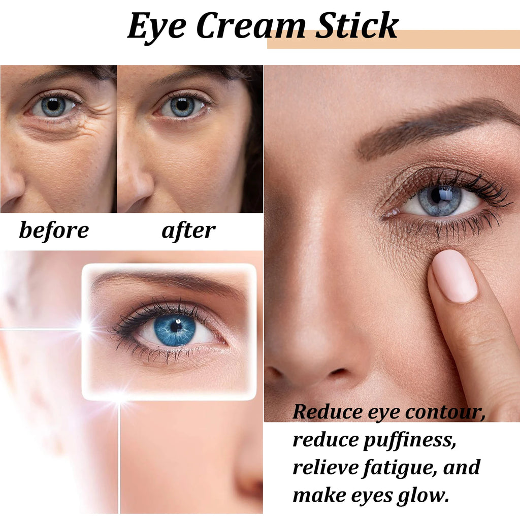Snail Eye Cream Stick Collagen Fade Fine Lines Wrinkle Lightening Dark Circles.