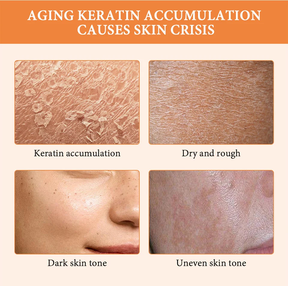 Original Exfoliating Gel Dead Spot Remover Brighten Peeling.