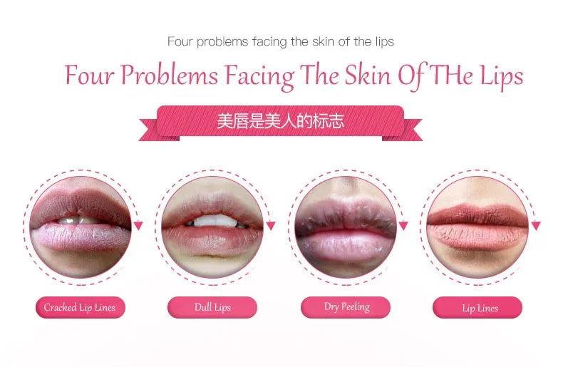 5/10Pcs Lip Mask Hydrating Repair Remove Lines Blemishes Lighten Lip Line Collagen Gel Mask