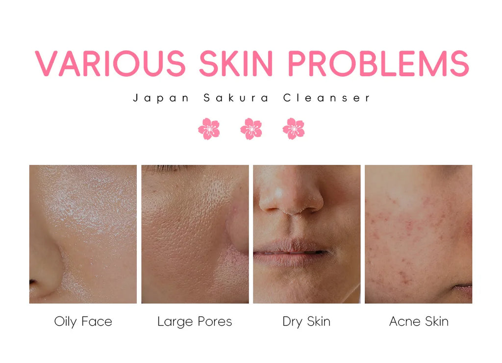 LAIKOU Sakura Cleanser Gentle Deep Cleaning Oil Control Moisturizing Shrink Pores Face Skin Care.