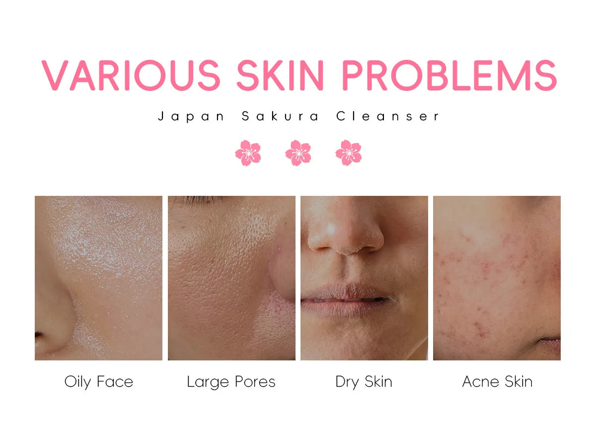 LAIKOU Sakura Cleanser Gentle Deep Cleaning Oil Control Moisturizing Shrink Pores Face Skin Care.