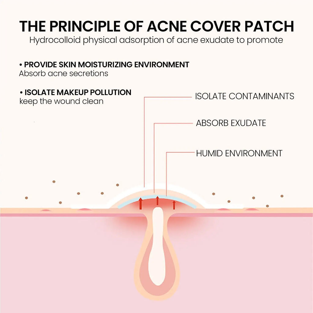 Multi-Color Star Acne Patches, Facial Acne Patches, Concealer Acne Patches, And Pimples patches, Ultra-thin